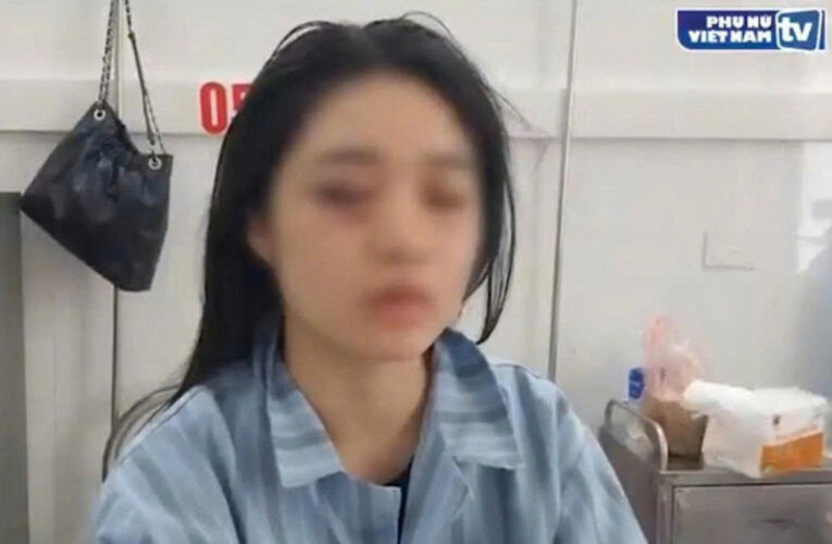 Hưng Yên: Một nữ sinh phải nhập viện cấp cứu vì bị đánh hội đồng