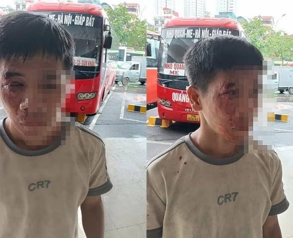 Phụ xe bất ngờ bị đánh túi bụi tại bến xe Giáp Bát